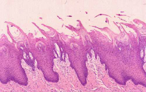 picture of filiform papillae